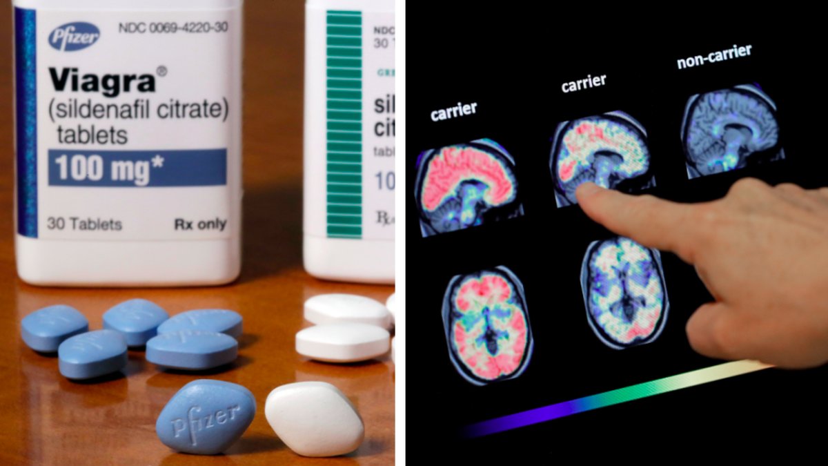 En ny studie visar att Viagra kan minska risken för Alzheimers. 